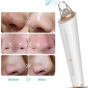 دستگاه میکرودرم ۴کاره مکنده جوش سرسیاه و پاکسازی پوست (Blackhead Remover)